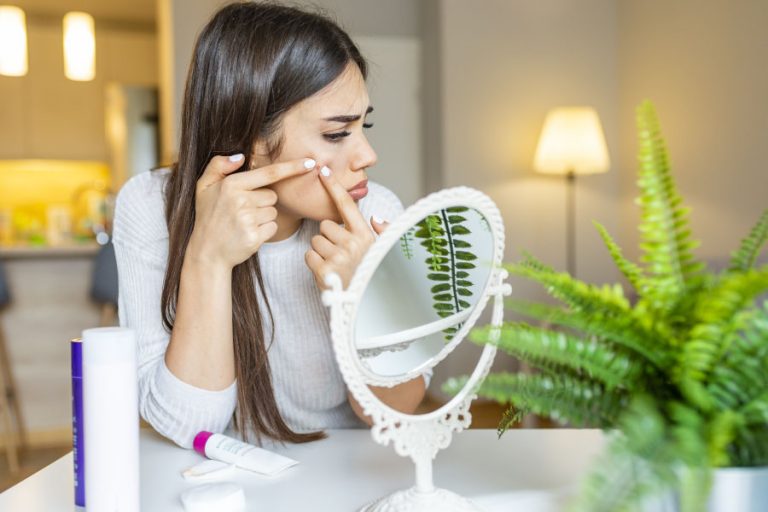 CBD oil for acne